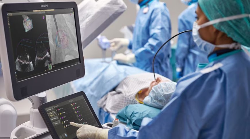 Philips showcases next level cardiology innovations for improved patient care at TCT 2024